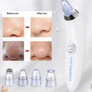 Dead Skin Remover Black Head Remover